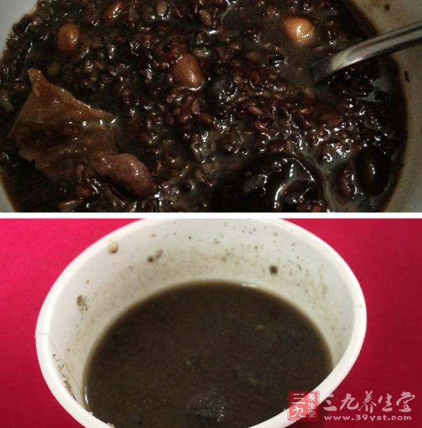 <em>头发</em>少<em>怎么</em>办 <em>补充营养</em>促生发(3)-三九养生堂