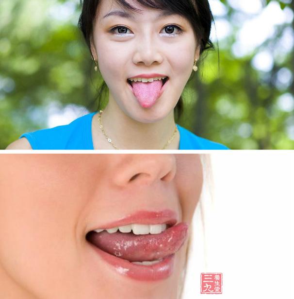 成人口疮(3)