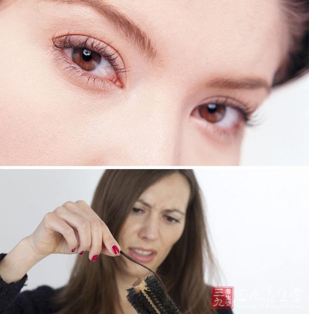 气血不足的表现 如何解决女性常见健康问题 - 三九养生堂