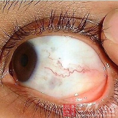 女人总是觉得<em>胸罩紧</em>是怎么回事 - 三九养生堂