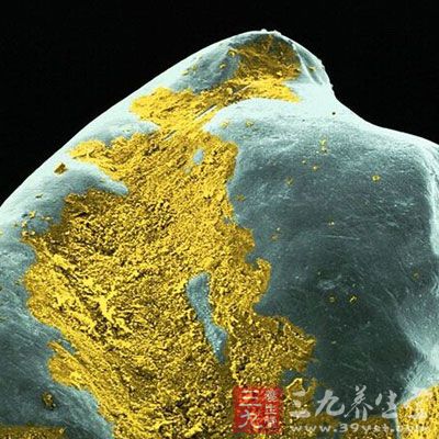 蓝色的球形地毯细菌和红细胞紧紧贴着黄牙表面。