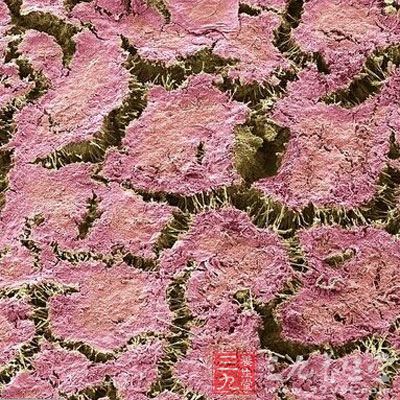 这张照片可以看出牙齿上还有很多彩色的肉眼不可见的微笑粒子。