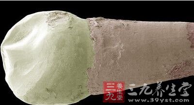 这是被放大的智齿，底部已经被细菌分解，只剩下冠状的头部。