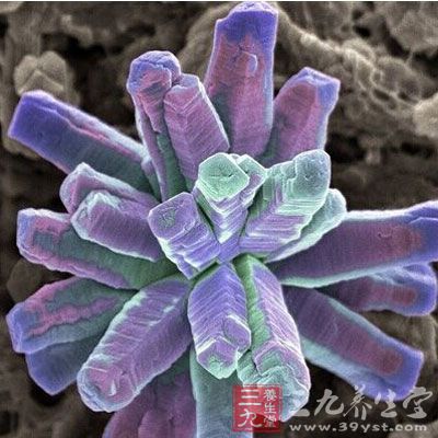附着在牙齿上的磷酸钙晶体。