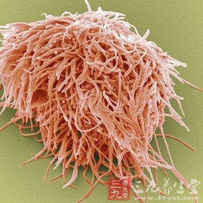 这看起来很想海底的某种生物是吗?但其实是点状细菌聚集在牙齿上的放大图。