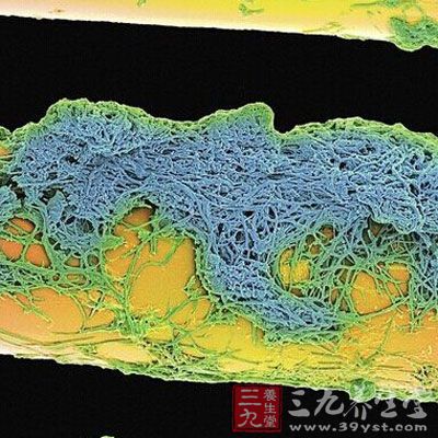 这是附着在牙刷上的菌斑，如果不及时清理可能会引起蛀牙、牙龈炎或者更多其他口腔疾病。