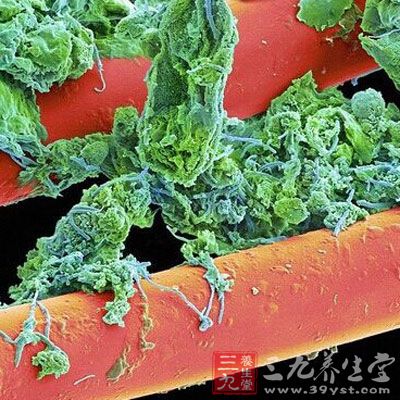 任何一把不干净的牙刷被放大后的样子都会让你感到害怕。