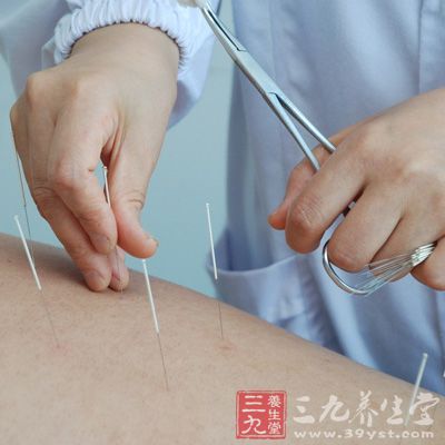 中医常识 肩周炎针灸诊疗技术(2)