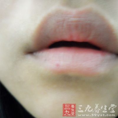 嘴唇发白 警惕消化系统疾病唇色变白是一种不健康的颜色.