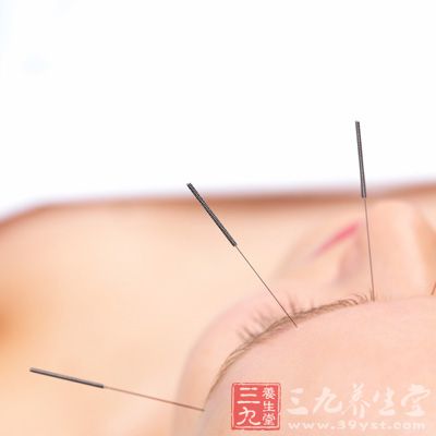 中医针灸 耳穴针刺减肥减脂肪不减水份