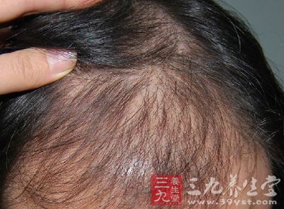 机体缺乏维生素C和铁质。