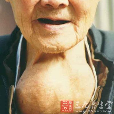 研究表明 甲状腺疾病治疗新突破(2)