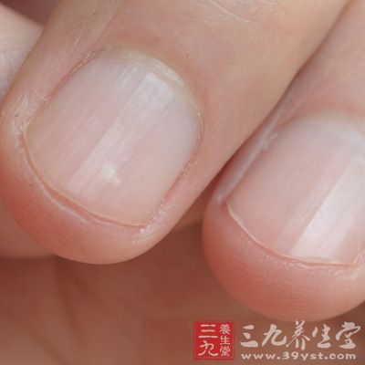 指甲易断、“月牙儿”小