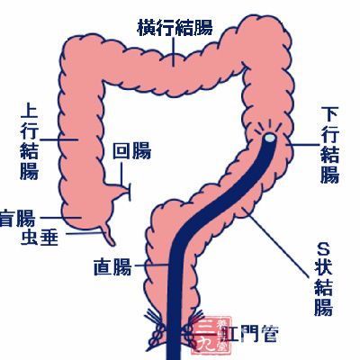 大肠的主要生理功能是传化糟粕，大肠的功能失调表现为排便的异常
