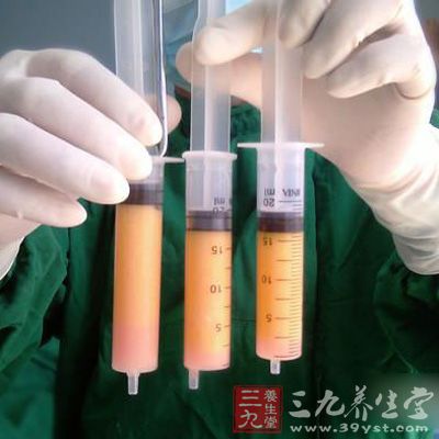 日媒称抽脂手术风险或致感染和内脏损伤