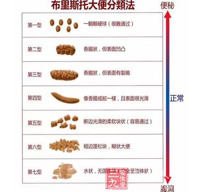 大便形状只需作为改变饮食结构的参考信息