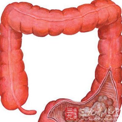 某些结肠疾病如克隆氏病或溃疡性结肠炎可能增加结直肠癌的发病机会