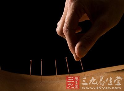 针灸可以说是我们中国传统医学中的一朵奇葩