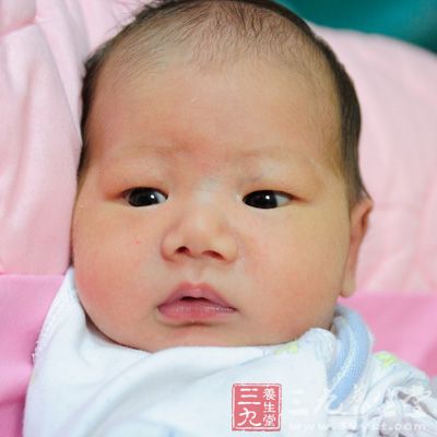 新生儿黄疸怎么回事 新生儿黄疸如何治疗