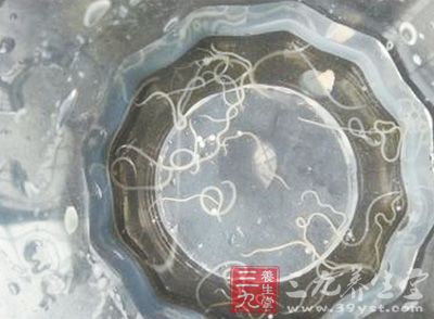 新鲜带鱼爬出不明寄生虫 鉴定为异尖线虫