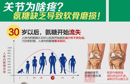 30岁以后,氨糖开始流失 30岁以后,氨糖开始流失
