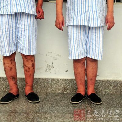 为帮男子戒毒搬迁 后遇毒友复吸再被抓