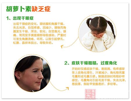 胡萝卜素缺乏症