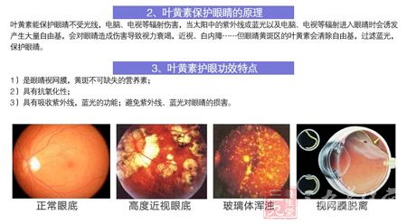 叶黄素护眼的功效特点 叶黄素护眼的功效特点
