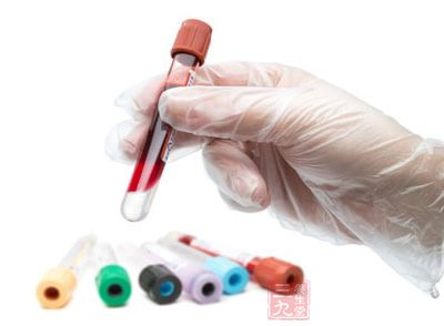 血液测试诊断癌症又有新进展