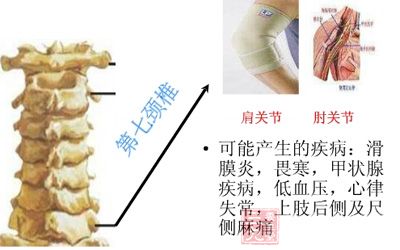 第七颈椎段:主要关联甲状腺、食管、气管、心肺、肱肌等 第七颈椎段:主要关联甲状腺、食管、气管、心肺、肱肌等