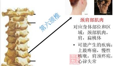 第六颈椎段:主要关联甲状腺、食道、气管、心肺、上肢等 第六颈椎段:主要关联甲状腺、食道、气管、心肺、上肢等