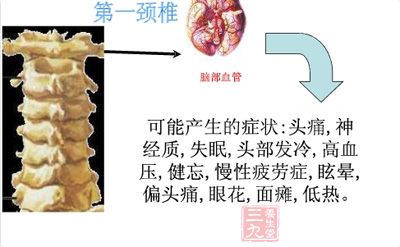 第一颈椎段:主要关联头、耳、鼻、喉、脸等 第一颈椎段:主要关联头、耳、鼻、喉、脸等