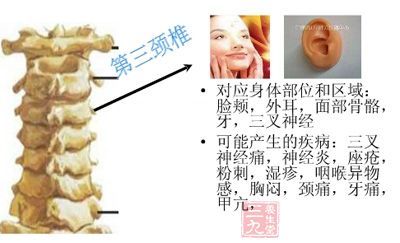 第三颈椎段:主要关联咽、颊、肩、横膈等 第三颈椎段:主要关联咽、颊、肩、横膈等