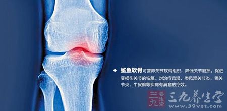 鲨鱼软骨可营养关节软骨组织 鲨鱼软骨可营养关节软骨组织