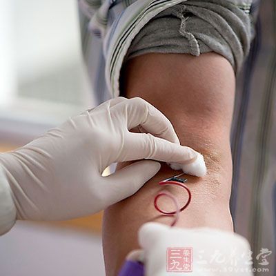 极易癌变的黑斑息肉病