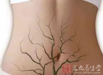 长年累月,脏器在毒素的侵袭下承受着巨大的压力 长年累月,脏器在毒素的侵袭下承受着巨大的压力