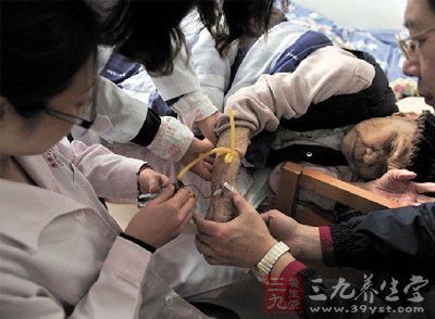 霍勇称不存在普遍滥用心脏支架现象