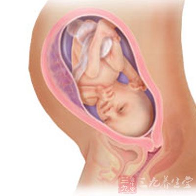 胎心监护是正确评估胎儿宫内状况的主要检测手段
