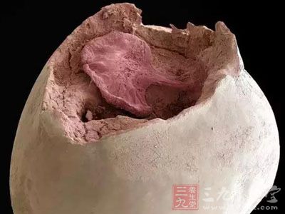 点状细菌聚集在牙齿上的放大图.