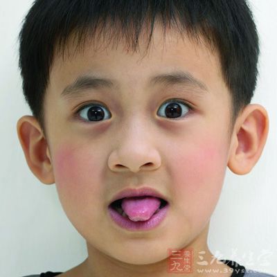 舌苔厚黄是怎么回事 看舌苔知身体状况(9)