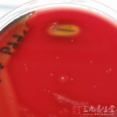 a链球菌群又称化脓性链球菌