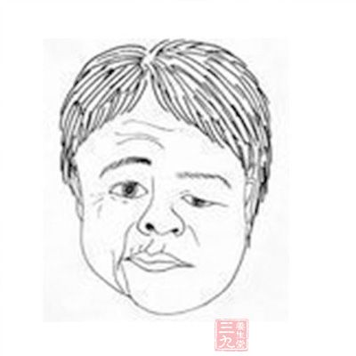 女子脸皮抽动不敢见人 医院检查是面肌<em>痉挛</em>