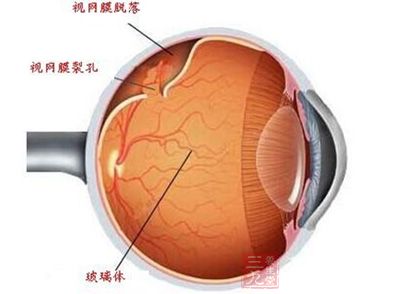 游玩目不暇接看风景 阿姨视网膜看脱落