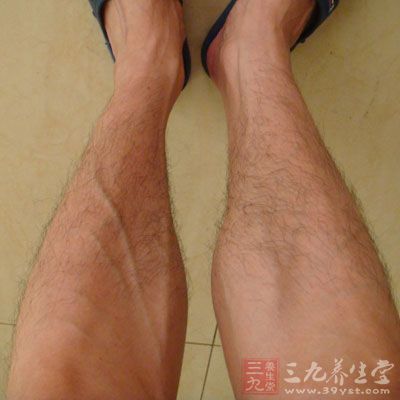 小腿烧灼般疼痛 小腿烧灼般疼痛