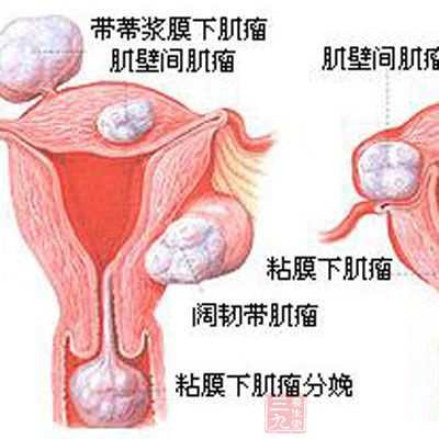 即具有正常促性腺激素的卵巢功能紊乱