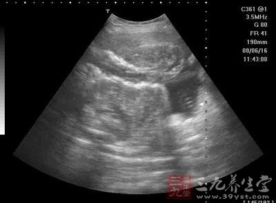 女子治不孕却成十级伤残 计生服务站负赔偿责