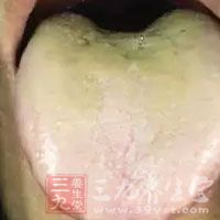 此乃脾虚湿盛的舌象特点