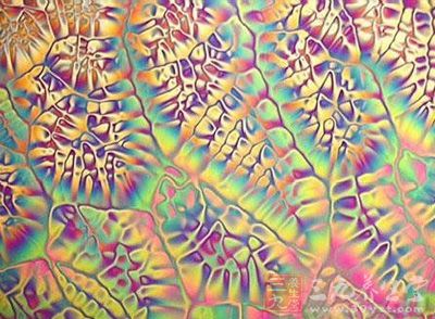 研究人员发明特殊荧光试剂 癌干细胞现身