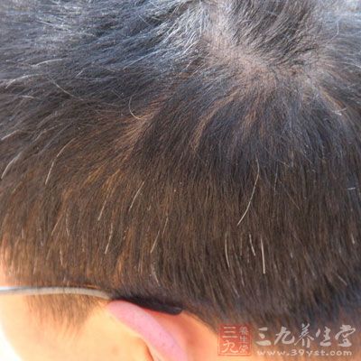 敲胆经的最佳时间(13) - 三九养生堂