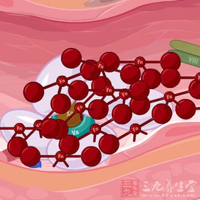 近九成血友病患者处于漏诊误诊中